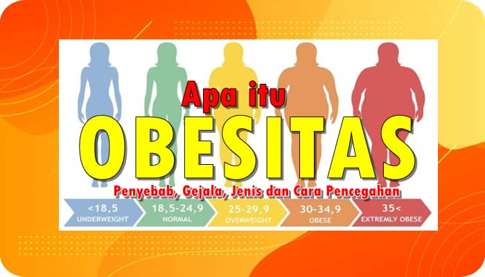 Obesitas adalah Penyebab, Gejala, Jenis dan Cara Pencegahan